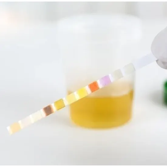 urine ketone body test